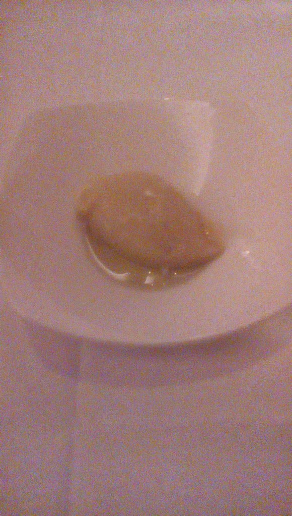 IMG_20160408_2224138_rewind